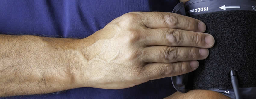 image representing blood pressure monitoring